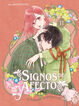 Signos de afecto 11