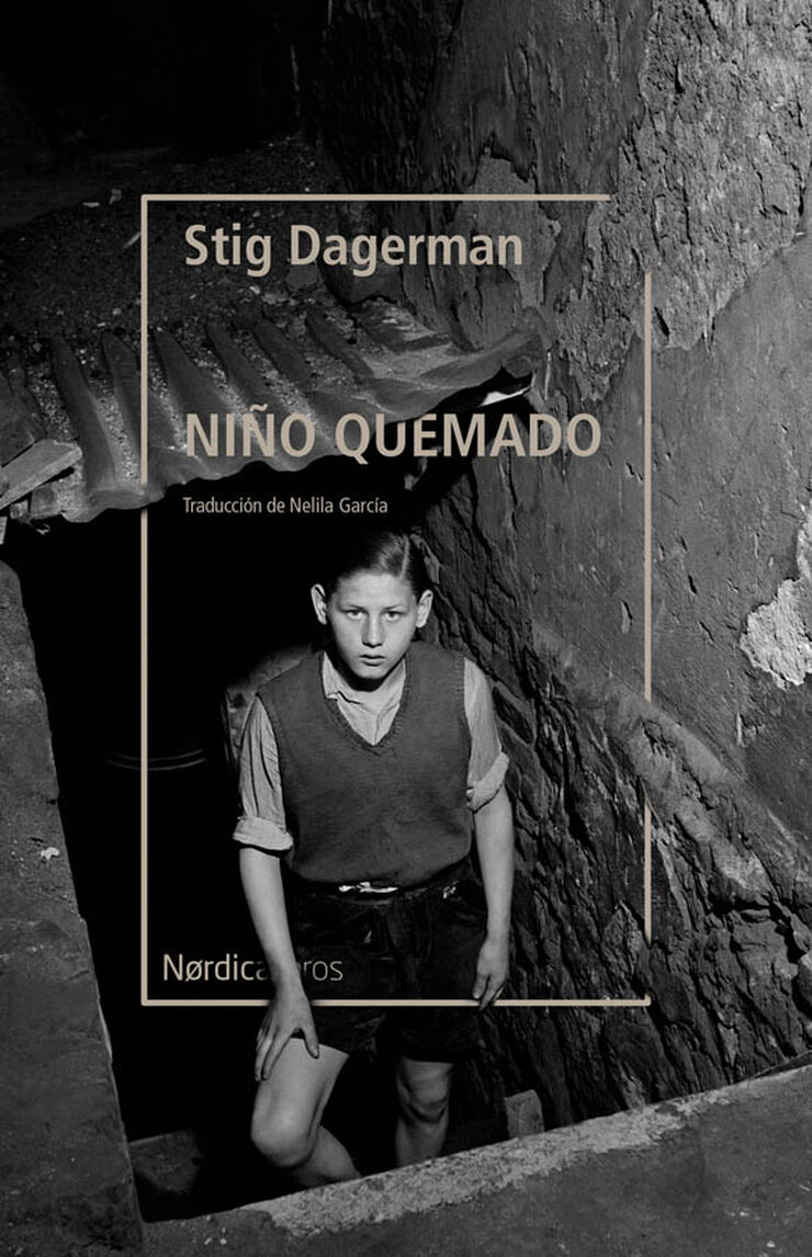 Ni&ntilde;o quemado